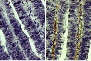 anti-Collagen, Type V (COL5) antibody (Biotin)