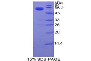 SDS-PAGE analysis of Cow Coagulation Factor VII Protein. (Factor VII Protéine)
