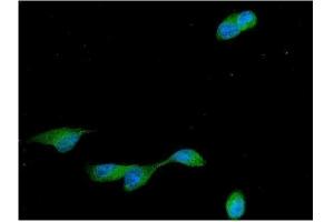 IF analysis of CCNB2 using anti-CCNB2 antibody (ABIN7600750).