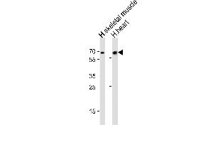 Western blot analysis of lysates from human skeletal muscle and human heart tissue (from left to right), using Cry2 Antibody (R579) at 1:1000 at each lane.