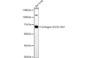 Western blot analysis of extracts of Rat lung, using Collagen X/COL10 antibody (8604) at 1:500 dilution. (COL10A1 anticorps)