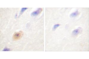 Peptide - +Immunohistochemical analysis of paraffin-embedded human brain tissue using CSantibody. (Exportin 2 anticorps)