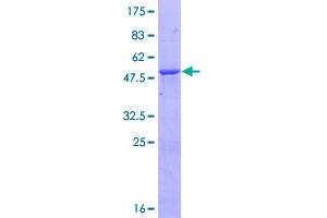 Image no. 1 for HECT Domain Containing 3 (HECTD3) (AA 1-210) protein (GST tag) (ABIN1306511)