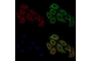 ABIN6260004 and ABIN6268779 staining Hela cells by IF/ICC.