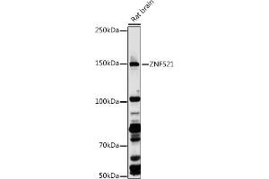 Western blot analysis of extracts of Rat brain, using ZNF521 antibody (ABIN7271496) at 1:1000 dilution. (ZNF521 anticorps  (AA 210-420))