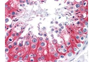 Immunohistochemistry (IHC) image for anti-Stromal Interaction Molecule 1 (STIM1) (AA 24-686) antibody (ABIN614666)