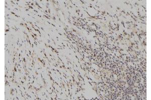 ABIN6277699 at 1/100 staining Human gastric tissue by IHC-P. (CSTA anticorps  (C-Term))