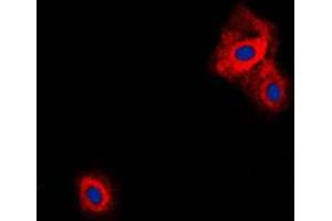 Immunofluorescent analysis of VGF staining in Raw264. (VGF anticorps  (C-Term))