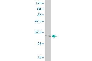 Western Blot detection against Immunogen (37. (FOXL1 anticorps  (AA 132-240))