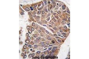 Immunohistochemistry (IHC) image for anti-V-Akt Murine Thymoma Viral Oncogene Homolog 2 (AKT2) antibody (ABIN3002942) (AKT2 anticorps)