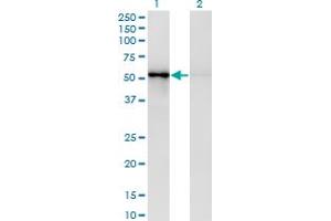 Western Blot analysis of ZNF207 expression in transfected 293T cell line by ZNF207 monoclonal antibody (M03), clone 6H8. (ZNF207 anticorps  (AA 1-110))