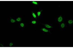 Immunofluorescence staining of HepG2 Cells with ABIN7127811 at 1:50, counter-stained with DAPI. (Recombinant SKP2 anticorps)