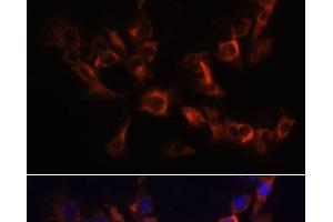 Immunofluorescence analysis of C6 cells using ARL13B Polyclonal Antibody at dilution of 1:100. (ARL13B anticorps)