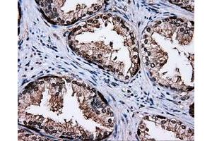 Immunohistochemical staining of paraffin-embedded liver tissue using anti-MCL1 mouse monoclonal antibody. (MCL-1 anticorps)