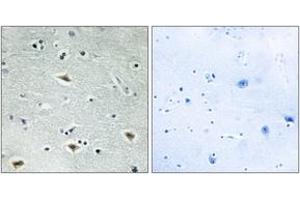 Immunohistochemistry analysis of paraffin-embedded human brain tissue, using MTG16 Antibody. (CBFA2T3 anticorps  (AA 261-310))