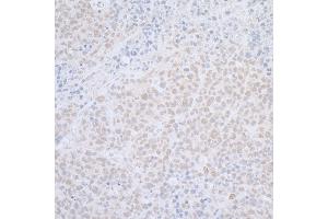 Immunohistochemistry (IHC) image for anti-ElaC Homolog 2 (ELAC2) (AA 776-826) antibody (ABIN7455054) (ELAC2 anticorps  (AA 776-826))