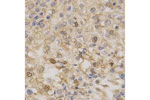 Immunohistochemistry (IHC) image for anti-Protein Kinase, AMP-Activated, alpha 1 Catalytic Subunit (PRKAA1) (AA 1-300) antibody (ABIN3021788)