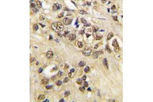 Image no. 2 for anti-Myc Proto-Oncogene protein (MYC) antibody (ABIN357365) (c-MYC anticorps)