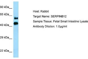 Host: RabbitTarget Name: SERPINB12Antibody Dilution: 1. (SERPINB12 anticorps  (N-Term))