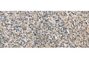 Immunohistochemistry of paraffin-embedded Human tonsil tissue using RAB3IP Polyclonal Antibody at dilution of 1:60(x200) (RAB3IP anticorps)