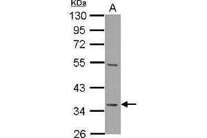 WB Image Decorin antibody detects DCN protein by Western blot analysis. (Decorin anticorps)