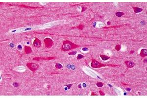 Human Brain, Cortex: Formalin-Fixed, Paraffin-Embedded (FFPE) (CAMK2B anticorps  (pThr286))