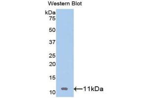 Western blot analysis of the recombinant protein. (IGF2 anticorps  (AA 25-91))