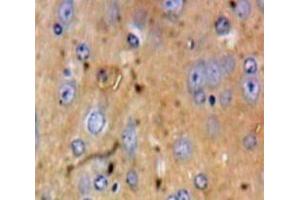 Used in DAB staining on fromalin fixed paraffin-embedded Brain tissue (HSPA4 anticorps  (AA 258-511))