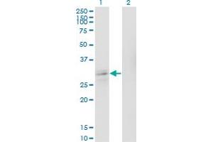 Western Blot analysis of ASCL1 expression in transfected 293T cell line by ASCL1 polyclonal antibody (A01).