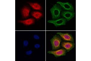 ABIN6257303 and ABIN6275012 staining Hela cells by IF/ICC. (KIF4A anticorps  (C-Term))