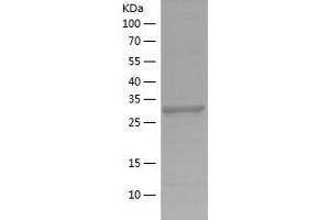Western Blotting (WB) image for Lactate Dehydrogenase A (LDHA) (AA 283-332) protein (His-IF2DI Tag) (ABIN7123707)