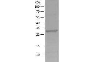 Western Blotting (WB) image for Lactate Dehydrogenase A (LDHA) (AA 283-332) protein (His-IF2DI Tag) (ABIN7123707) (Lactate Dehydrogenase A Protein (LDHA) (AA 283-332) (His-IF2DI Tag))