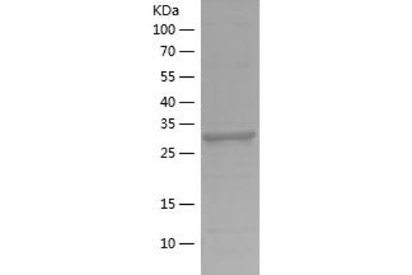 Lactate Dehydrogenase A Protein (LDHA) (AA 283-332) (His-IF2DI Tag)