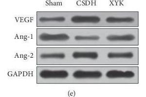 In the XYK group, HIF-1α and VEGF decreased, E3 ubiquitin-protein ligase parkin and 26S proteasome protein increased, and the Ang-1/Ang-2 ratio increased in the hematoma. (VEGFA anticorps  (AA 27-190))