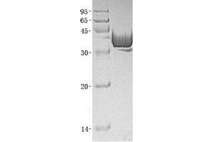 Validation with Western Blot (ALDOA Protein (Transcript Variant 1) (His tag))