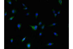 Immunofluorescent analysis of U87 cells using ABIN7149470 at dilution of 1:100 and Alexa Fluor 488-congugated AffiniPure Goat Anti-Rabbit IgG(H+L)