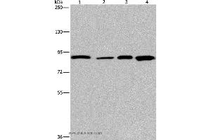 Western blot analysis of Mouse heart tissue and Hela cell, HUVEC cell and mouse skin tissue, using JUP Polyclonal Antibody at dilution of 1:1150 (JUP anticorps)