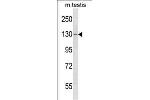 TBC1D2 Antibody (Center) (ABIN1538422 and ABIN2850064) western blot analysis in mouse testis tissue lysates (35 μg/lane). (TBC1D2 anticorps  (AA 438-465))