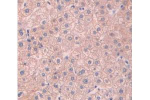IHC-P analysis of liver tissue, with DAB staining. (Asialoglycoprotein Receptor 2 anticorps  (AA 1-311))
