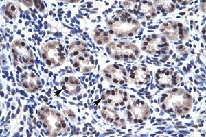 Image no. 1 for anti-Sp7 Transcription Factor (SP7) (C-Term) antibody (ABIN6735947)