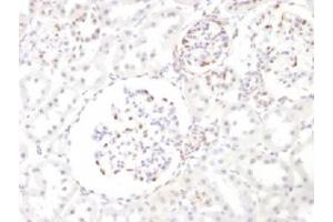 IHC testing of FFPE rat kidney with WT1 antibody.