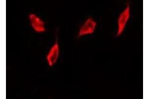 ABIN6267234 staining HT29 by IF/ICC.