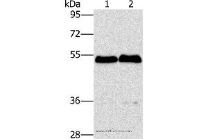 Western blot analysis of Mouse brain and liver tissue, using SPHK2 Polyclonal Antibody at dilution of 1:200 (SPHK2 anticorps)