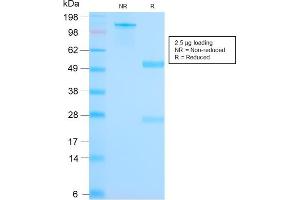 SDS-PAGE Analyis Purified Mammaglobin Recombinant Rabbit Monoclonal Ab (MGB1/2682R).