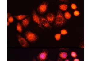Immunofluorescence analysis of HeLa cells using HRAS Polyclonal Antibody at dilution of 1:100 (40x lens). (HRAS anticorps)