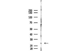 Western blot analysis of lysates from A2780 cells(starvation 24h treatment), using NET-5 Antibody at 1/1000 dilution.