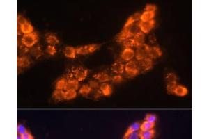 Immunofluorescence analysis of A431 cells using LAMC2 Polyclonal Antibody at dilution of 1:100 (40x lens). (LAMC2 anticorps)