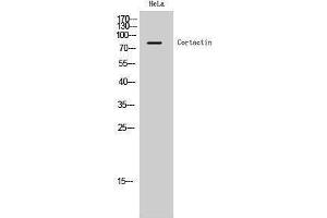 Western Blotting (WB) image for anti-Cortactin (CTTN) (Ser338) antibody (ABIN3174520) (Cortactin anticorps  (Ser338))