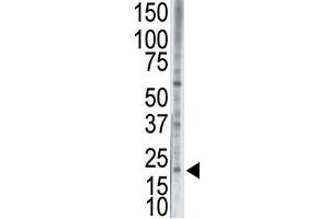 Image no. 1 for anti-BCL2-Associated X Protein (BAX) (N-Term) antibody (ABIN356811)