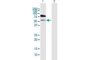 Western Blot analysis of RAD18 expression in transfected 293T cell line by RAD18 MaxPab polyclonal antibody. (RAD18 anticorps  (AA 1-495))